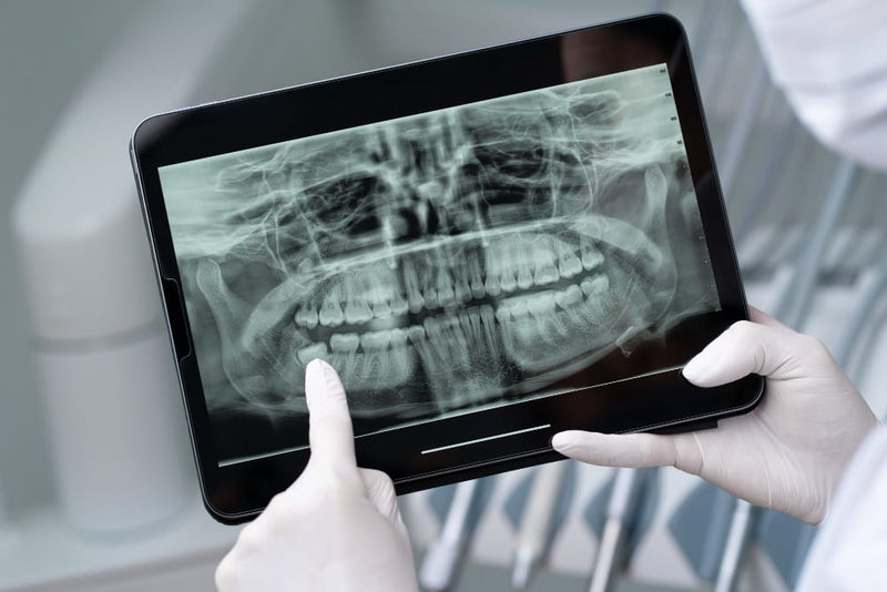 prodotti_e_forniture_per_radiologia